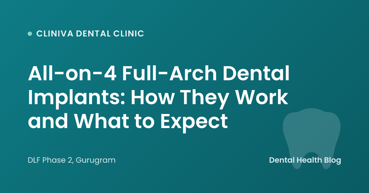 All-on-4 Full-Arch Dental Implants: How They Work and What to Expect