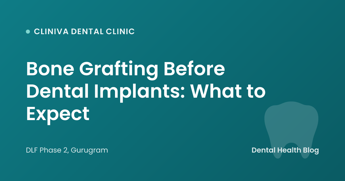 Bone Grafting Before Dental Implants: What to Expect