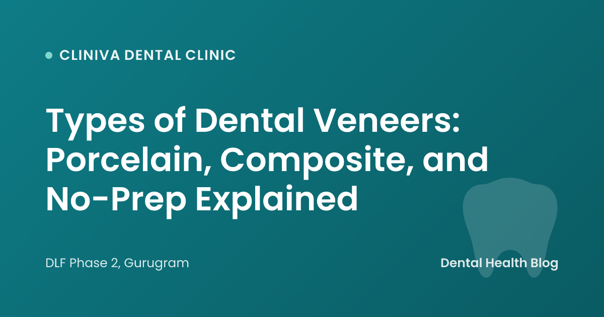Types of Dental Veneers: Porcelain, Composite, and No-Prep Explained