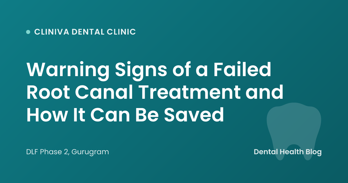 Warning Signs of a Failed Root Canal Treatment and How It Can Be Saved
