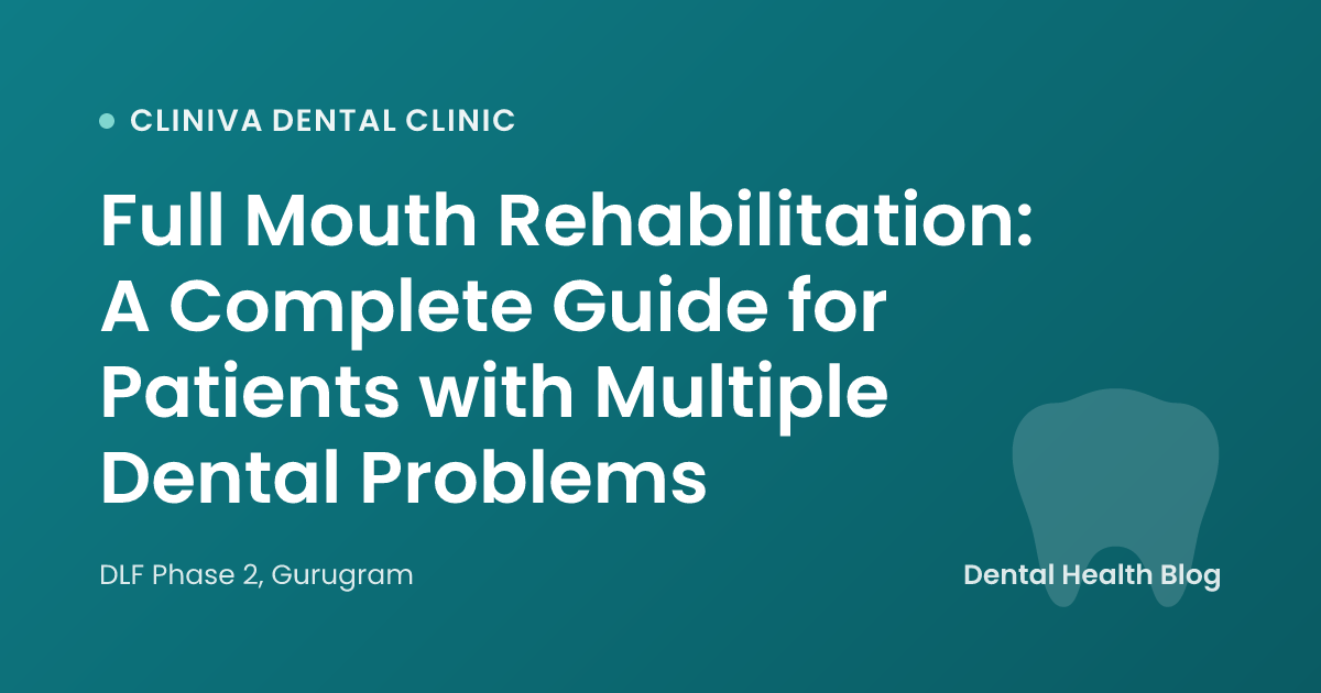 Full Mouth Rehabilitation: A Complete Guide for Patients with Multiple Dental Problems
