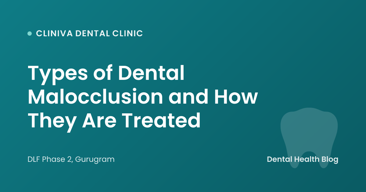 Types of Dental Malocclusion and How They Are Treated