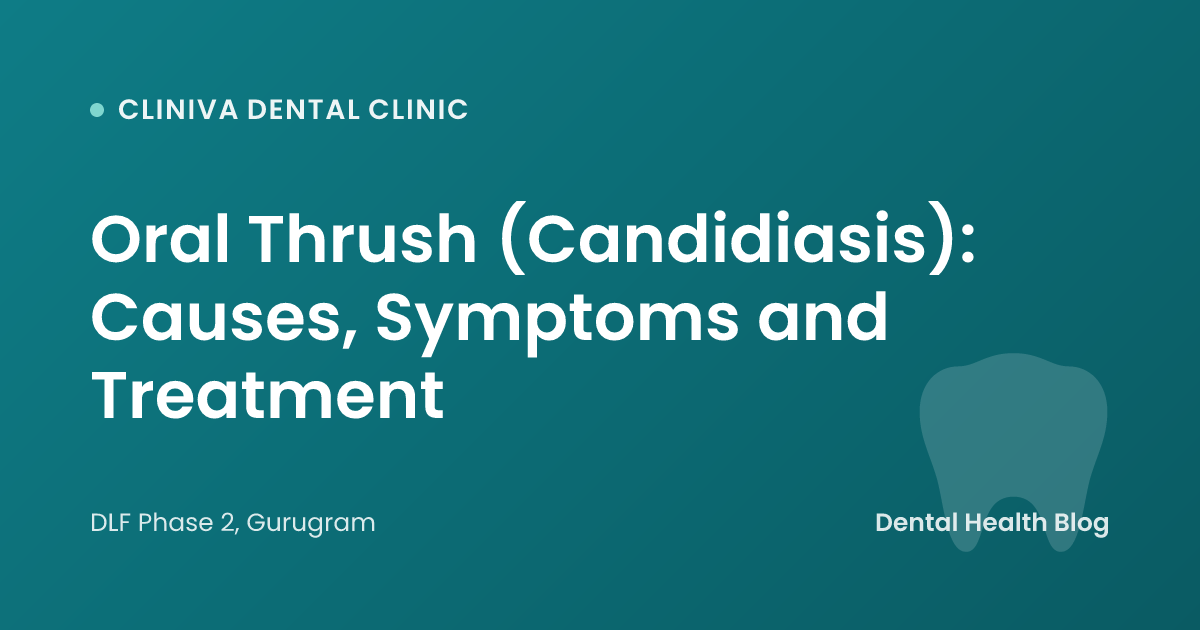 Oral Thrush (Candidiasis): Causes, Symptoms and Treatment